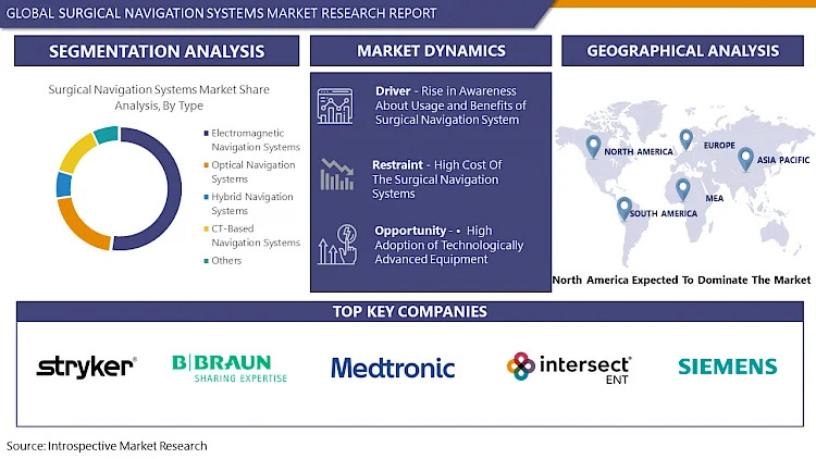 Surgical_Navigation_Systems_Market 